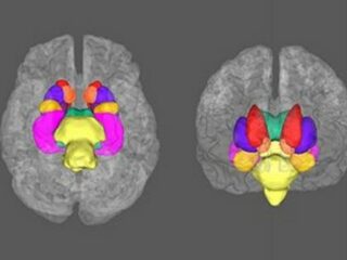 うつ病は脳の病気であることが科学的に判明か!? 史上最大級のリサーチで脳内の“質の低下”が発見される！