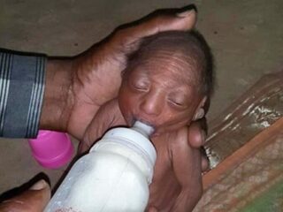 全身シワシワの赤ん坊 ― 育児放棄されヤギのミルクで育てられた2週間＝インド