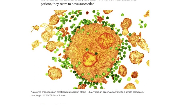 「体内からHIVが消えた」HIV感染の男性が史上2人目の寛解！ 幹細胞移植で…HIVもエイズも治る病に!?の画像1