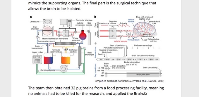 死後4時間経った豚の脳の復活に成功！意識は…生物の死の定義が揺らぐ衝撃実験！の画像2