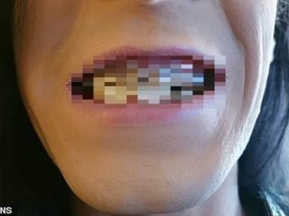 エナジードリンクを1日3リットル飲んだ男の口の中がヤバすぎる！ “超グロテスクな歯”に変貌… 医師警告「成分表示に疑問」