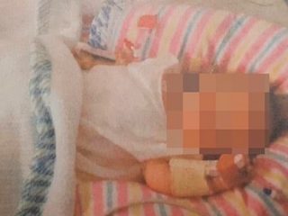 完全菜食主義者の子供、まったく成長せず歯もないことが判明！ 現在は反動で激太り…ヴィーガンキッズの悲惨な現実！