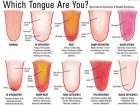 舌でわかるアナタの健康状態、4つのポイントを紹介！ 白っぽいとカンジダが… 健康改善法もアドバイス！