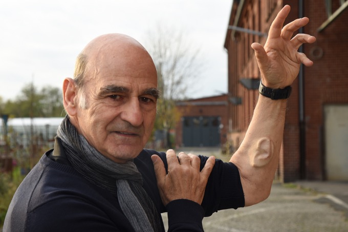 身体改造ニュースどこよりも詳しいまとめ！ マイクロチップ体内埋め込み、『クレイジージャーニー』を振り返る、トカナ編集長もサイボーグに…ケロッピー前田！の画像11