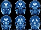 不平不満を言いまくると「脳が物理的に変わる」と科学的に判明! 愚痴を言うだけで「深刻なリスク」