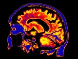 【衝撃】幻覚剤でうつ病を治す「サイケデリック療法」がもうすぐ実現! 英高級紙が掲載「LSDやキノコが脳を“作り変えて”うつ原因を消す」