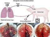 損傷した肺を“ブタにつないで”修復する技術が爆誕！ ハンパない効果を確認、肝臓・心臓・四肢再生にも応用へ!?（最新研究）