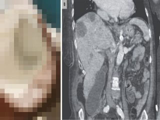 銀色のうんこをした女性が病院に駆け込む！ メタリックに輝くうんこを前に、医者は…