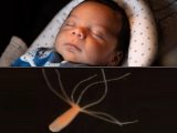 【新事実】「脳よりも先に睡眠があった」ことが判明! 脳がない生物でも眠る… 謎すぎる進化のメカニズム