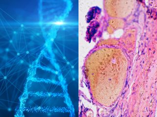 「全てのガンの3分の1の発生を止める方法」が発見される！ 遺伝子GLI1【ババ・ヴァンガの予言的中!!】