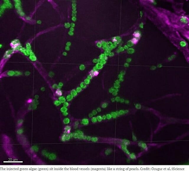 光を当てれば無呼吸でも死なない生物爆誕！ 血が緑色に… 「光合成人間」実現へ前進（最新研究）の画像2