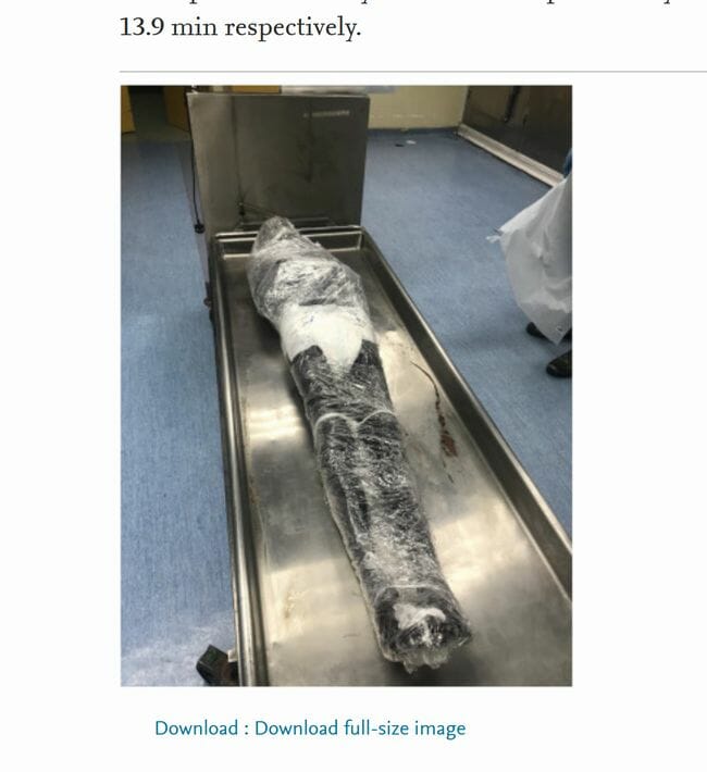 死体を食品用ラップで包んで保管するとどうなる!? 法医学誌掲載の実験結果に衝撃の画像2