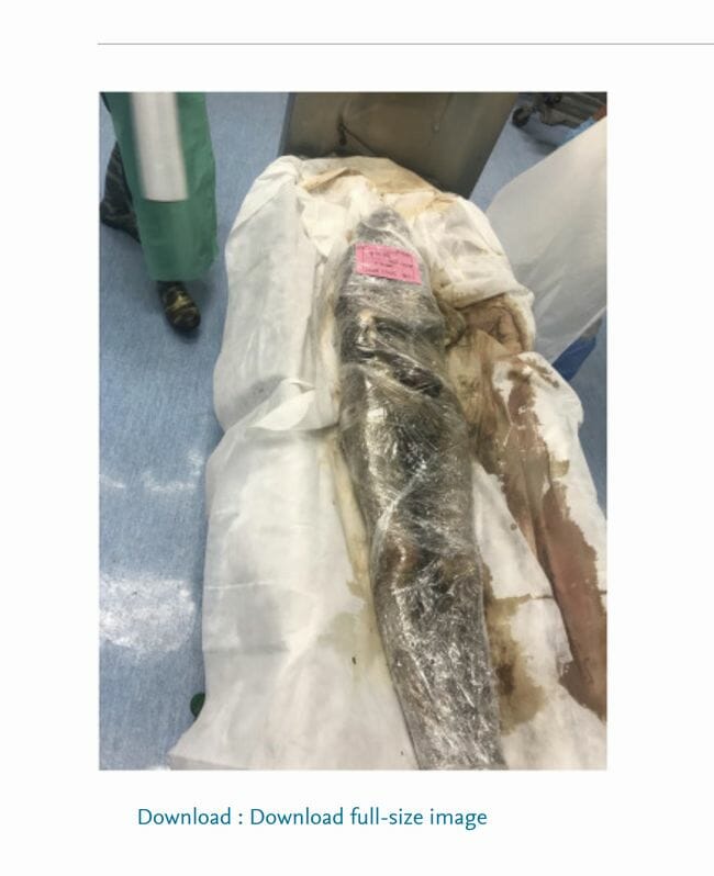 死体を食品用ラップで包んで保管するとどうなる!? 法医学誌掲載の実験結果に衝撃の画像3