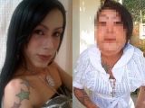 闇の美容整形で美女の顔面が崩壊… “ブラジルの扇風機おばさん”の悲痛な叫び 「私はいじめられ続ける!」