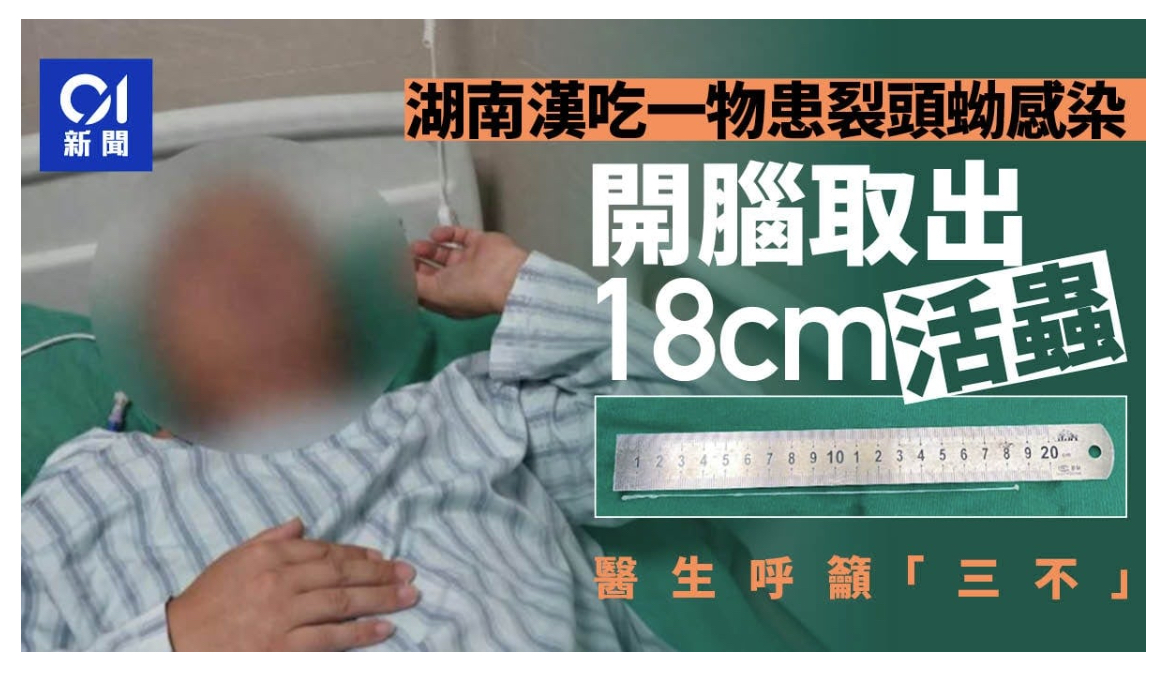 脳から18cmの「生きた虫」! 数年前の“生食”が招いた悪夢の正体の画像1