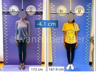 “モテるために脚の骨を切断”する「短足手術」の恐怖… 神経損傷のリスクを冒してでも手に入れたい“可愛さ”の代償とは
