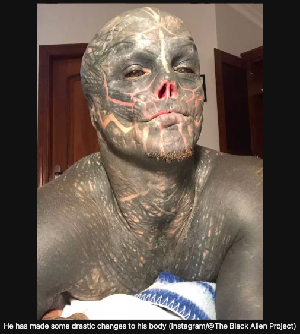 【閲覧注意】鼻と耳を切除し、全身を黒く染めた男「ブラック・エイリアン計画」の現在地の画像2