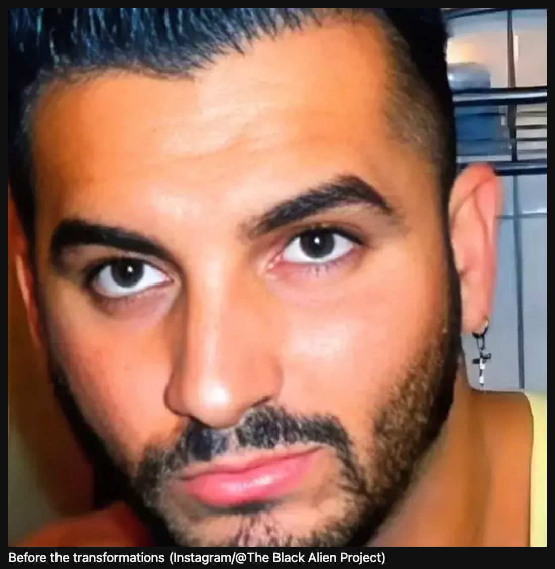 【閲覧注意】鼻と耳を切除し、全身を黒く染めた男「ブラック・エイリアン計画」の現在地の画像3