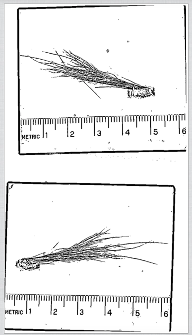 FBIが真面目に検証した「ビッグフットの毛髪サンプル」の鑑定結果の画像3