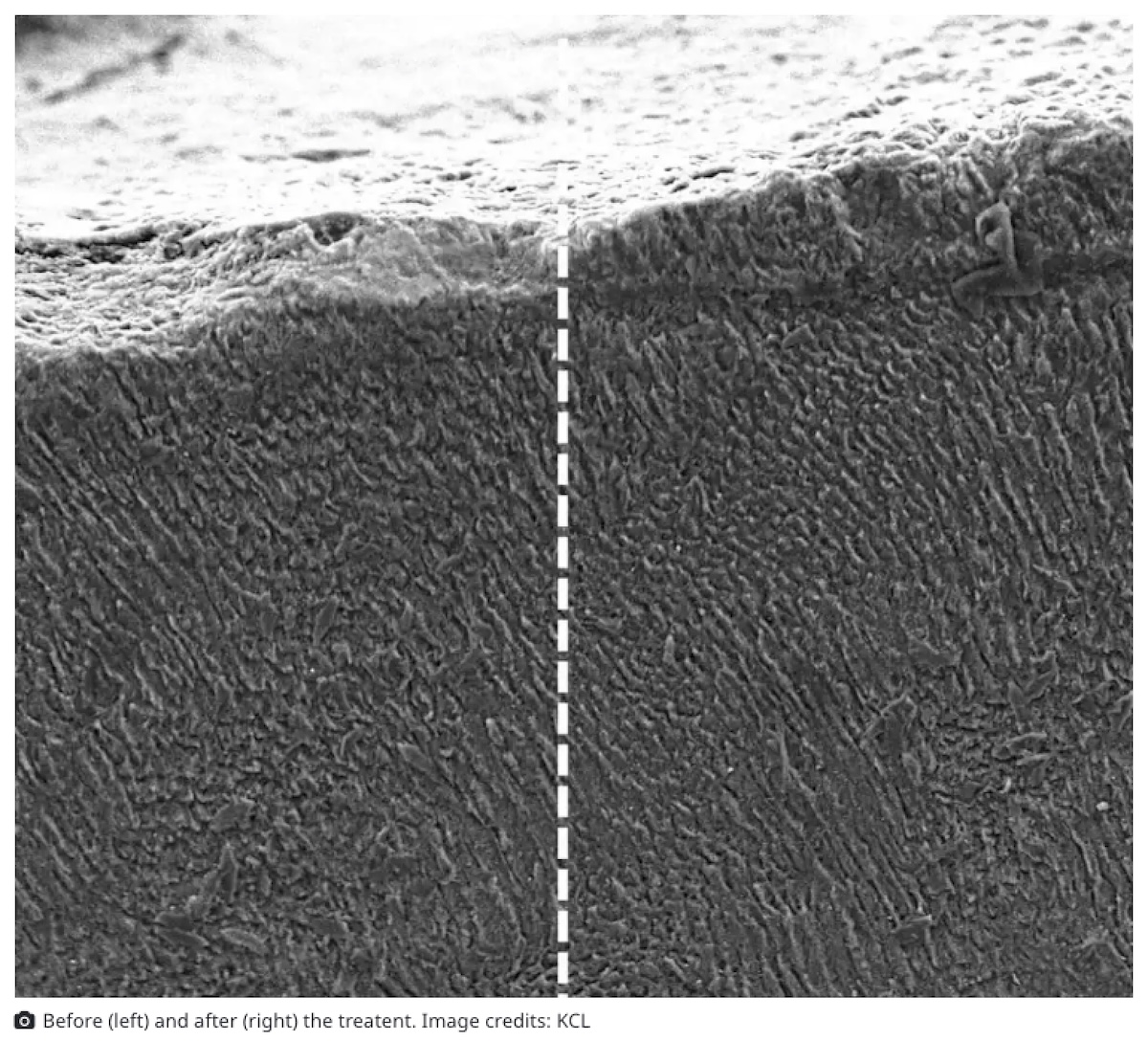 歯は“自己修復”する時代へ！ “髪の毛のタンパク質”に着想を得た新技術で失われたエナメル質が再生するの画像3