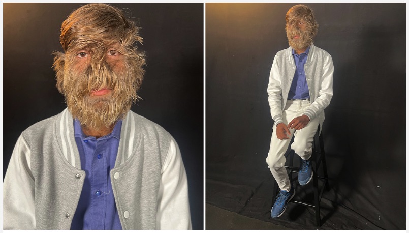 2025年に認定された「ヤバすぎるギネス世界記録」眼球が19mm飛び出す男、舌の長さ10cmの女性の画像3