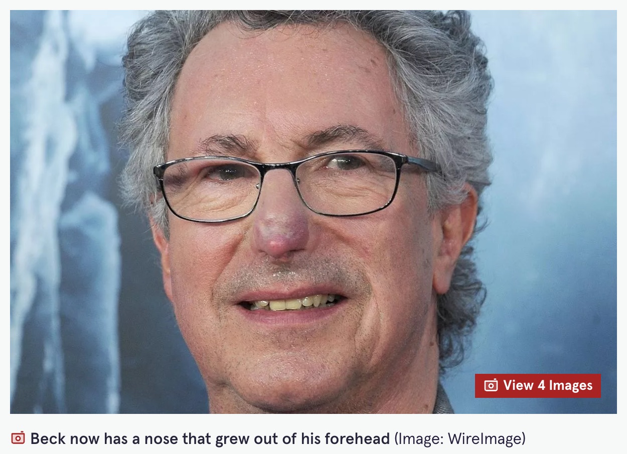 「死体が歩いて帰ってきた！」一度は死んだと思われた男が、満身創痍で奇跡の生還。標高8000mで"捨て置かれた男”が辿り着いた境地の画像4