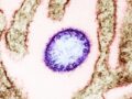 【致死率75%】インドで“治療法なし”のニパウイルスが拡散中