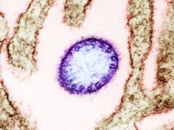 【致死率75%】インドで“治療法なし”のニパウイルスが拡散中。脳炎を引き起こす感染症が恐ろしすぎる…