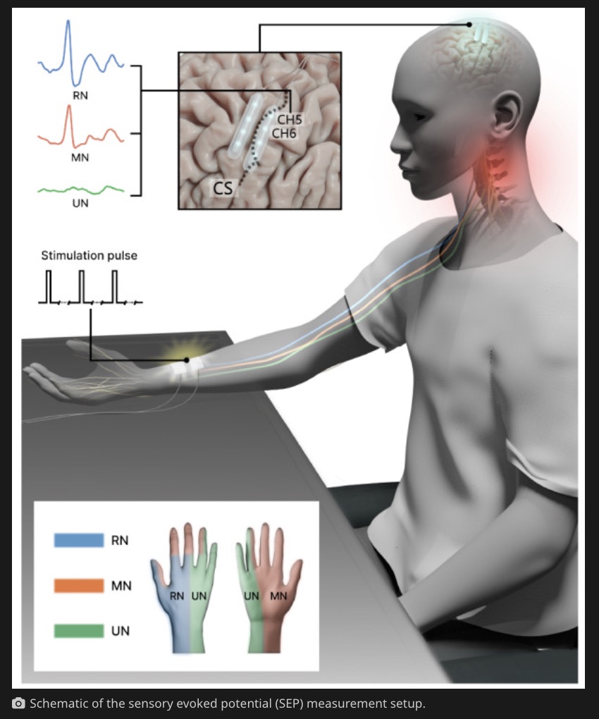 イーロン・マスクより先に中国が世界初の「脳インプラント」商用化を承認！ 麻痺患者が自力で水を飲める奇跡のデバイスの画像2