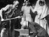 ハンマーで頭をフルスイング!? 1890年代の「究極の頭痛治療法」画像がネットで拡散… その真相とは