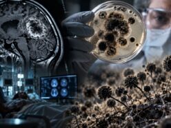 致死率6〜7割とされる「脳に巣食う黒いカビ」の検出率が2年で約4倍に！ 感染経路は不明